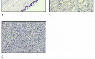 protuberant什么意思,protuberant中文翻译,protuberant用法及例句,protuberant怎么读