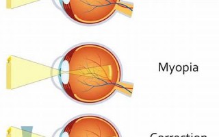 nearsighted什么意思,nearsighted中文翻译,nearsighted用法及例句,nearsighted怎么读